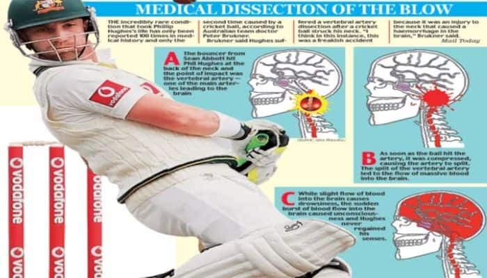 Journey of Injuries: Understanding the Risks on the Field