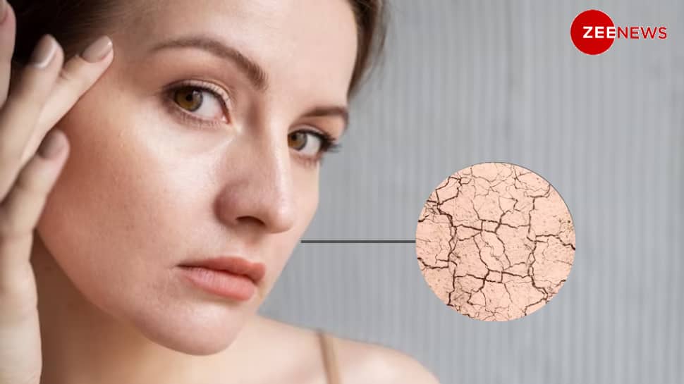Is Your Skin Dehydrated Or Is It Dry? Know The Difference