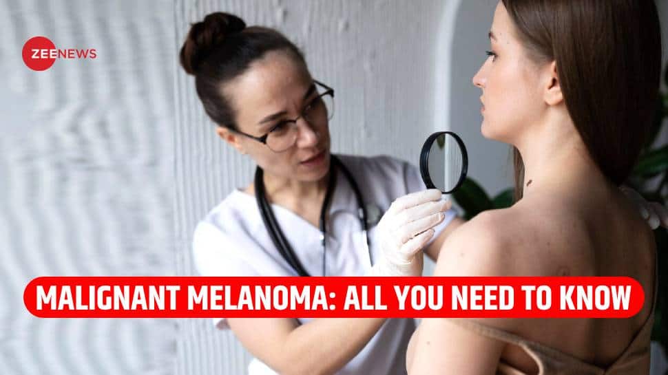 Malignant Melanoma: Know All About Deadly Form Of Skin Cancer That Duchess Of York Was Diagnosed With