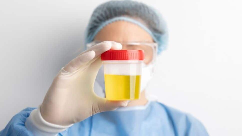 Cloudy Urine - Should You Be Worried? How To Get Right Diagnosis And Steps To Take 