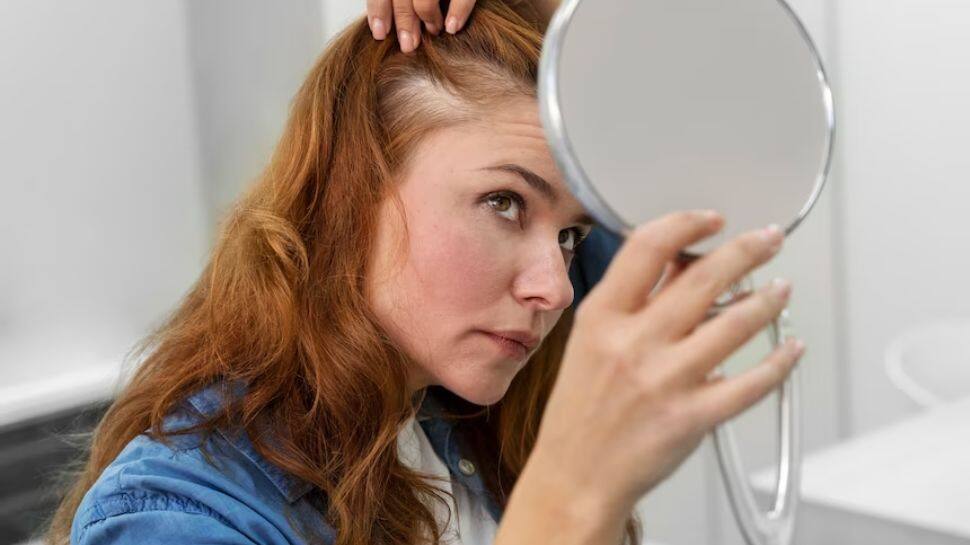 Hair Loss And Its Impact: 5 FAQs On Alopecia - Expert Answers