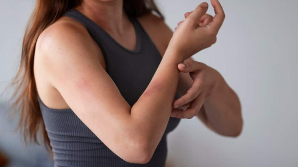 Feeling A Little Itchy? 5 Ways In Which Shingles Can Affect Your Body Beyond Skin