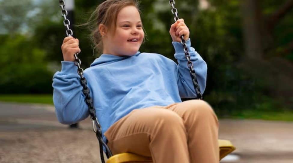 What Is Down Syndrome? A Perspective As Per Ayurveda
