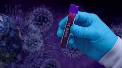 New Covid Variant KP.2: Check Symptoms; Is It More Infectious? Experts Say...