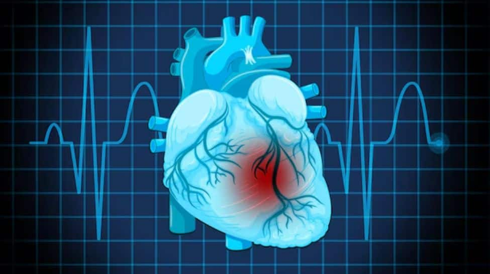 Outlook On Emerging Therapies In Interventional Cardiology