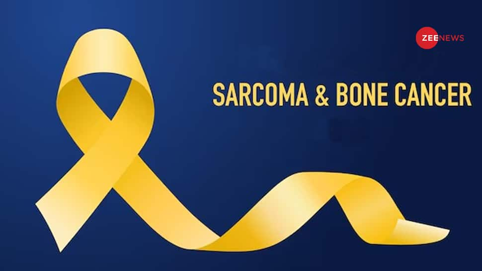 Unveiling Sarcoma Or Bone Cancer: Understanding Diagnosis And Detection Methods