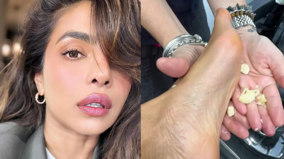 Priyanka Chopra’s Surprising Foot Care Hack: Garlic For Relief?