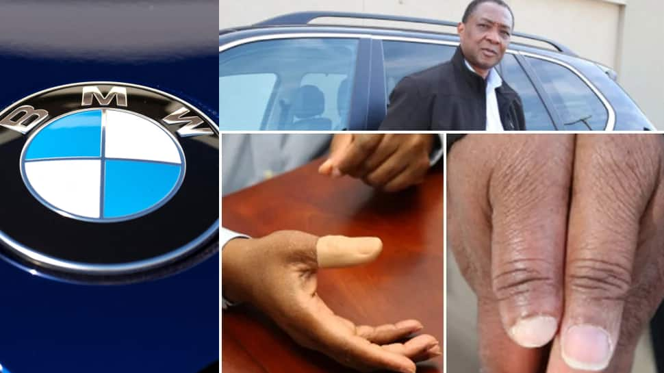 BMW Door Feature Causes Man Lose His Thumb, Slapped &#039;Rs 16 Crore&#039; In Damages