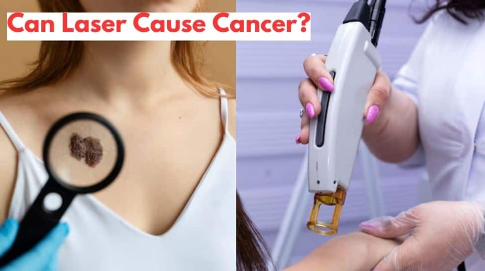 Can Laser Cause Cancer? Check Experts Say On This