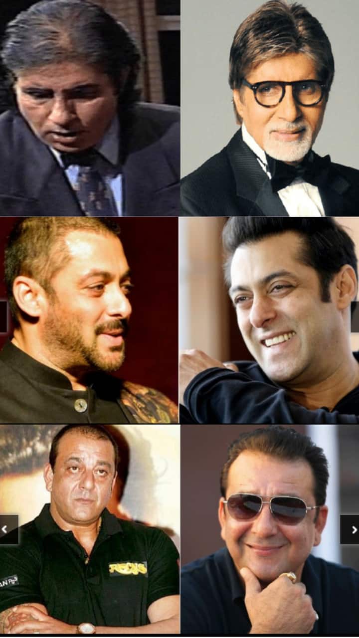 8 Bollywood Celebrities Who Underwent Hair Transplant