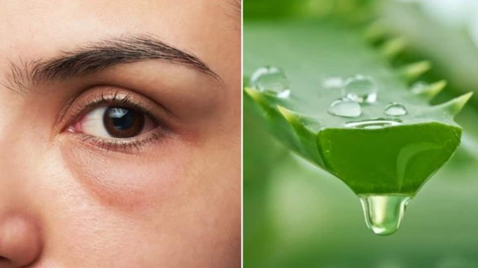 Aloe Vera Gel