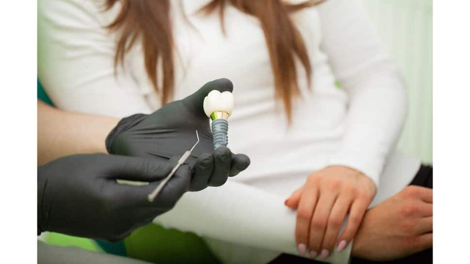 Dental Implants In Turkey: A Comprehensive Guide To Affordable And High-Quality Care