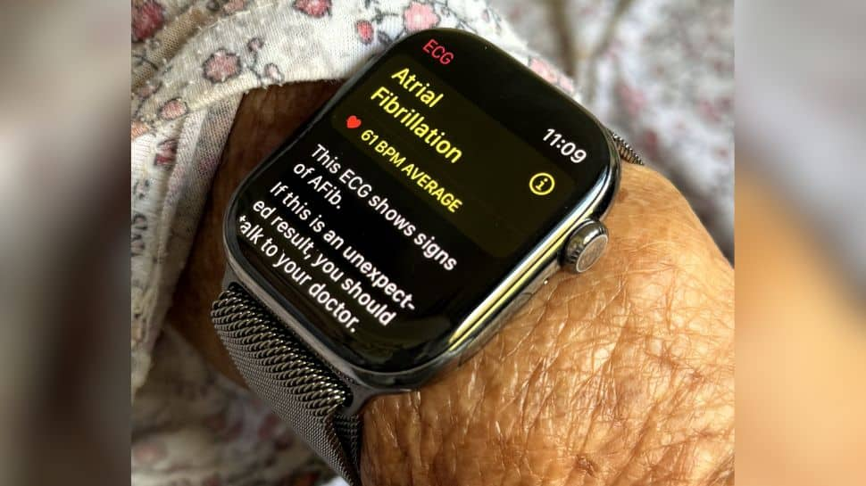 Apple Watch Series 10 Saves Elderly Woman By Detecting Irregular Heartbeat: Netizens React To Life-Saving Feature