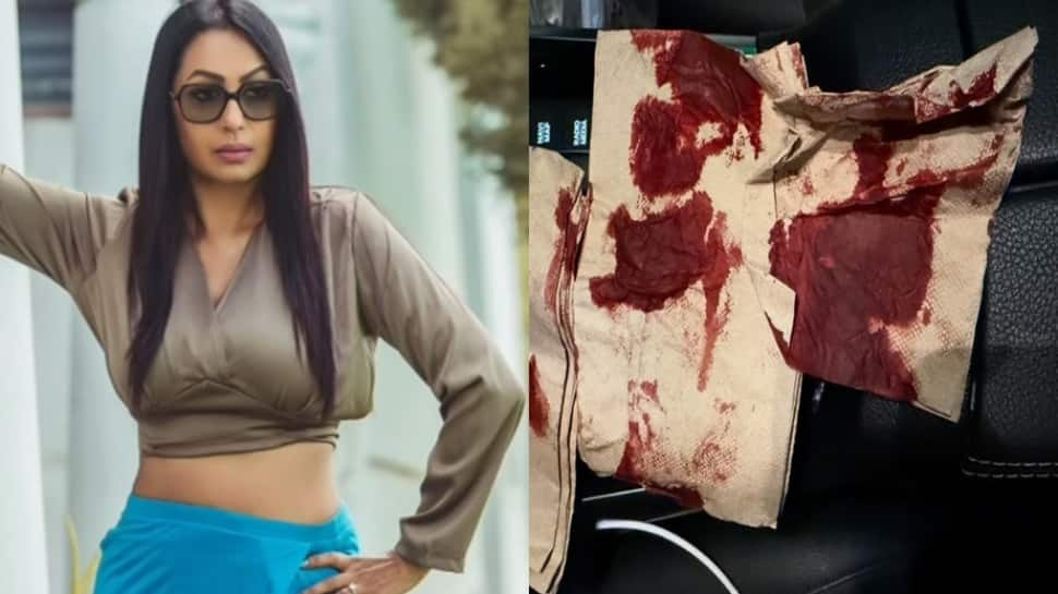 Actress Kashmera Shah Meets With Accident; Says 'Thank u god...'