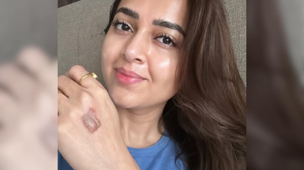 Tejasswi Prakash Suffers Burn Injury On 'Celebrity MasterChef' Set