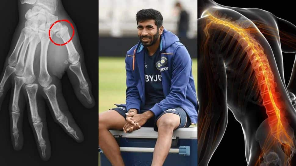Jasprit Bumrahs Injury Track Record: From Thumb Fracture In 2018 To Back Spasm In 2025 - In Pics