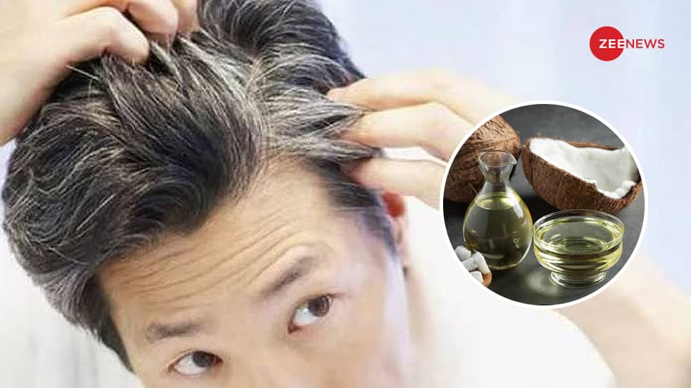 White Hair? Coconut Oil Will Make White Hair Black Naturally, Mix THESE 2 Things