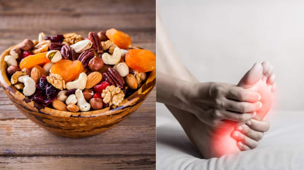 5 Best Dry Fruits To Reduce High Uric Acid Naturally And Improve Joint Health