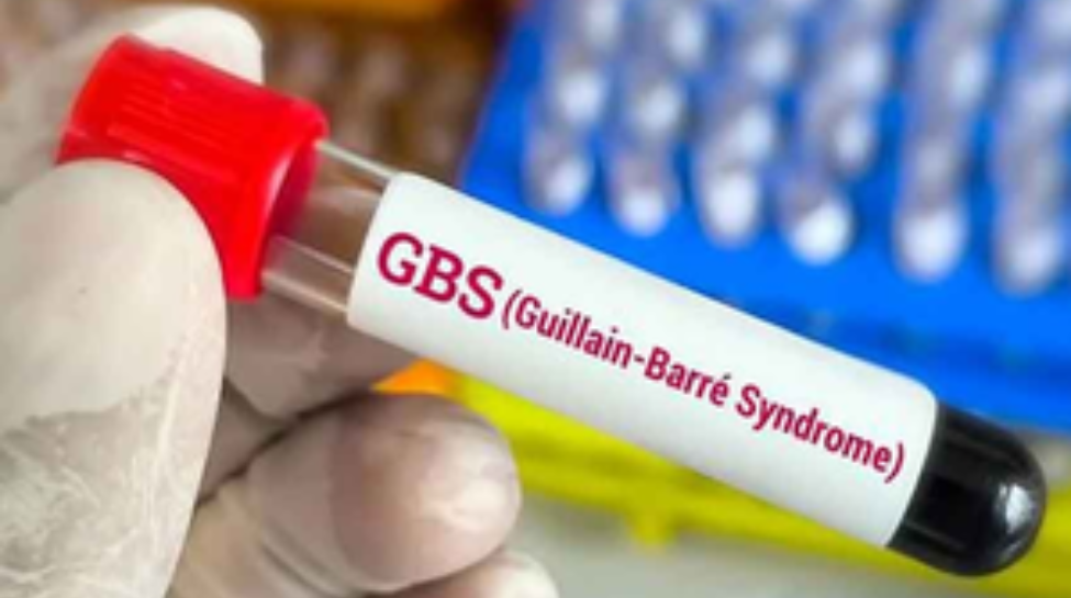 GBS Outbreak: 12 Deaths Linked To GBS In Maharashtra – Health Dept Issues Advisory GBS Outbreak: 12 Deaths Linked To GBS In Maharashtra – Health Dept Issues Advisory