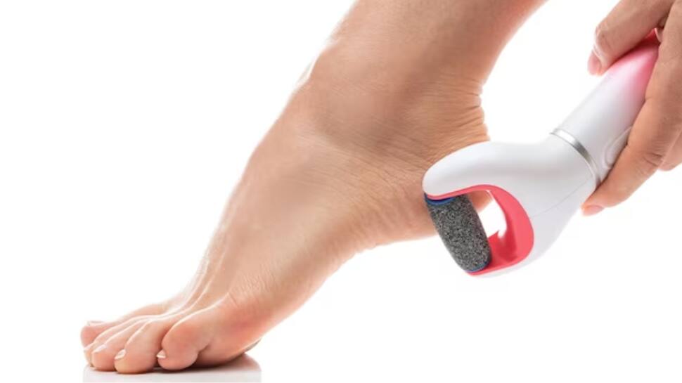 Foot Callus Remover Deals: Smooth Feet for Less