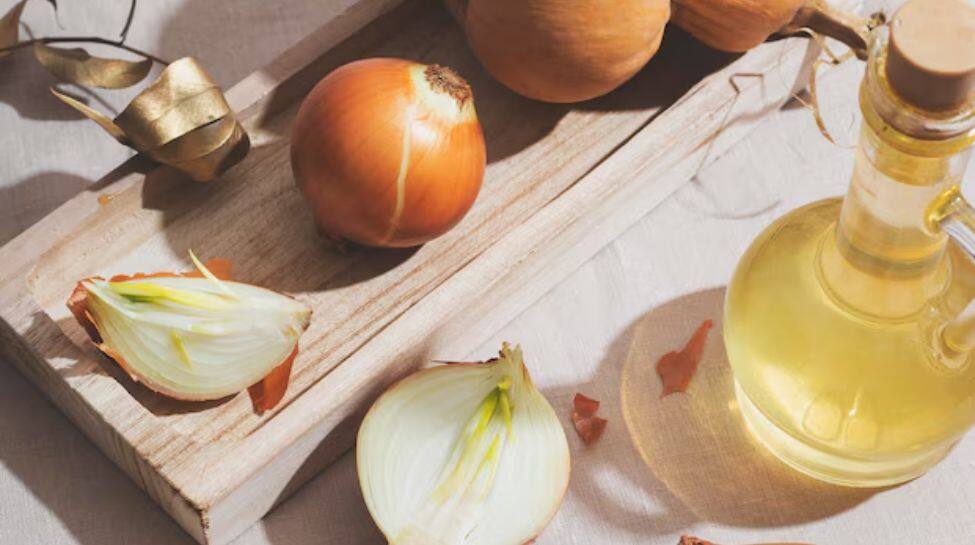 8. Onion Oil