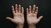 Rare signs on palm