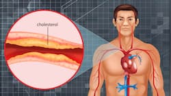 New Cholesterol-Lowering Pill Shows Promise In Cutting Heart Attack Risk