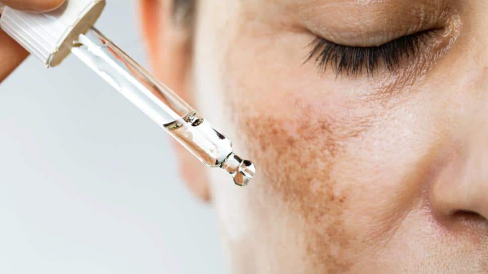 Reveal Brighter Skin: Your Morning Hyperpigmentation Routine