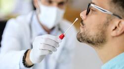 When Should A Patient With Mild Cold Symptoms Consider Taking An RT-PCR Test?
