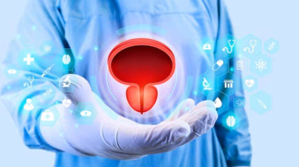 Bladder Cancer In India- Concerning Statistics And The Urgent Call For ...