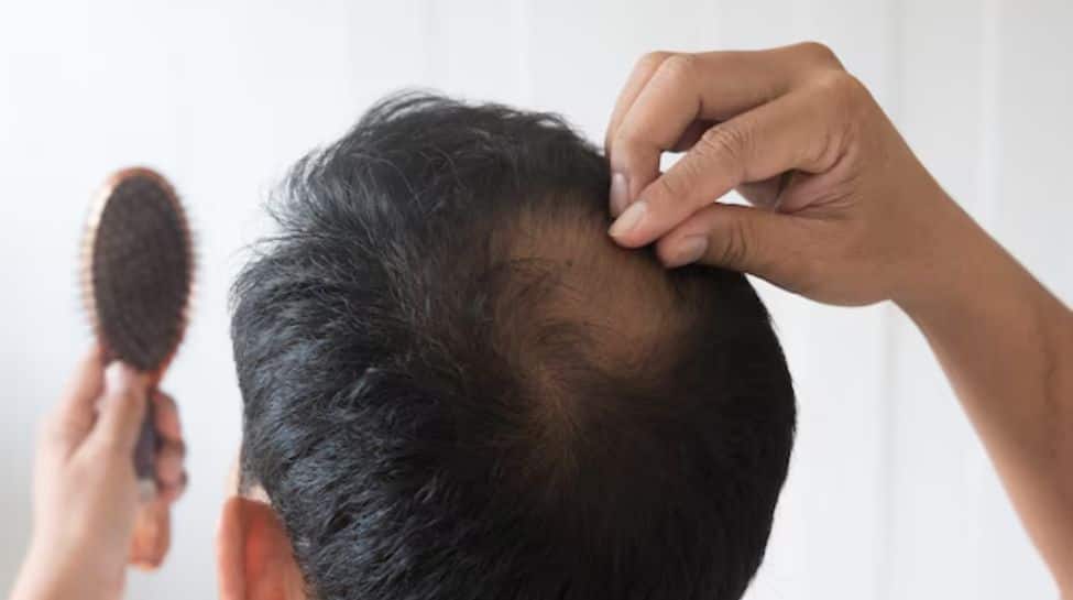Top 5 Myths About Hair Loss— Debunked By Science