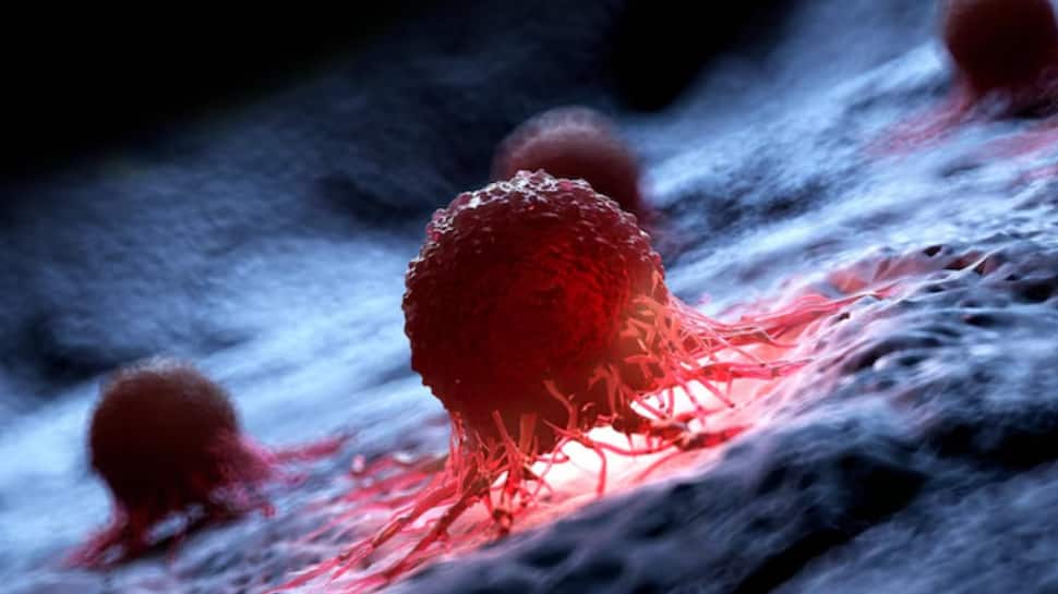 What Makes AML So Dangerous? Understanding One Of The Fastest-Growing ...