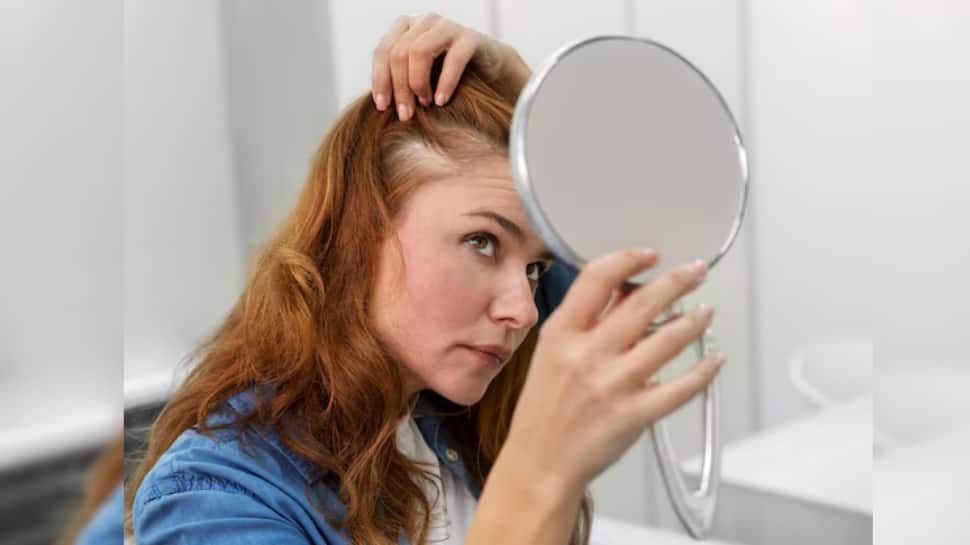 Hair Fall In Monsoon? Here’s How To Prevent It With Simple And Effective Rainy Season Hair Care Tips