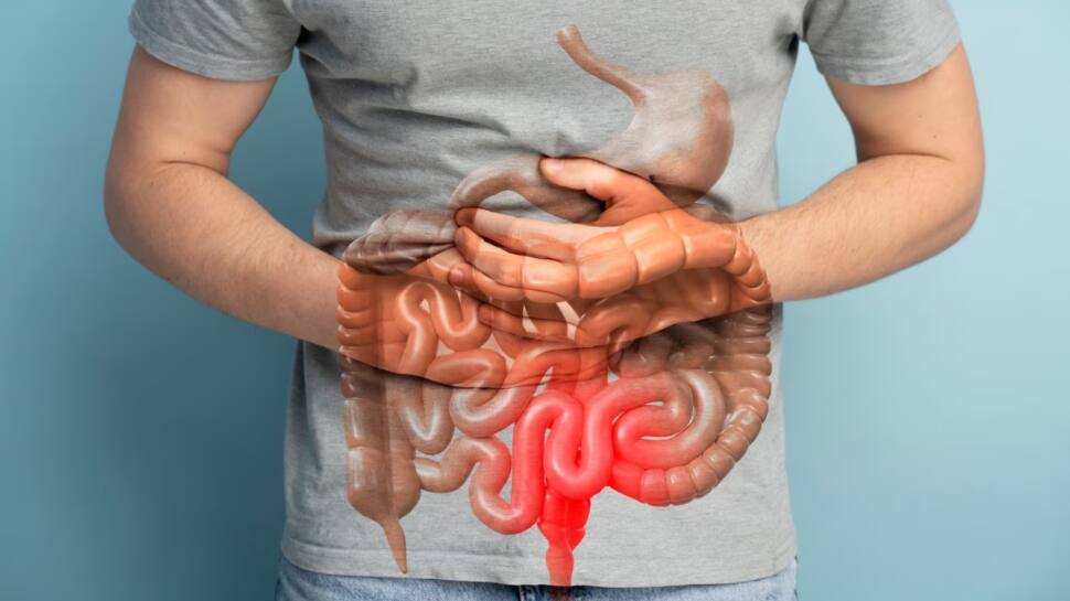 10 Natural Prebiotic Foods That Improve Gut Health, Digestion, And Overall Wellness 10 Natural Prebiotic Foods That Improve Gut Health, Digestion, And Overall Wellness