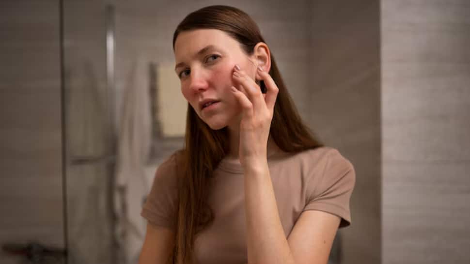 Is Your Diet Destroying Your Skin? 5 Common Foods That May Be To Blame