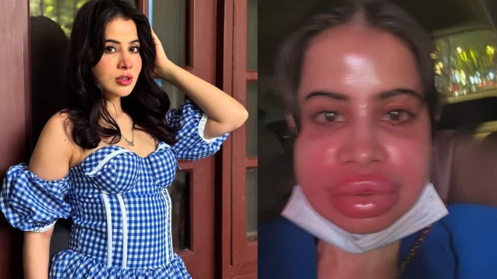 VIRAL VIDEO: Uorfi Javed Flaunts Her 'Filler-Free Face' After Massive Trolling – WATCH