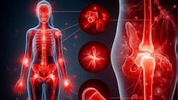 Does Inflammation Cause Social Deprivation & Heart Disease Risk? Study Reveals