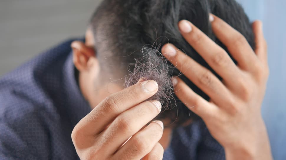 Social Media Stress Linked to Teen Hair Loss: Indian Experts Advise