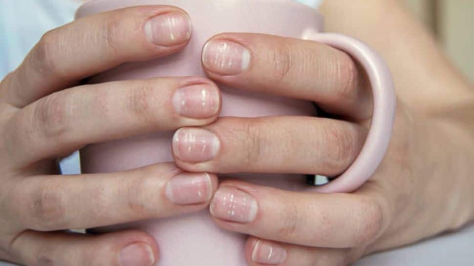 These 8 Fingernail Problems Reveal Serious Health Issues – Dont Ignore