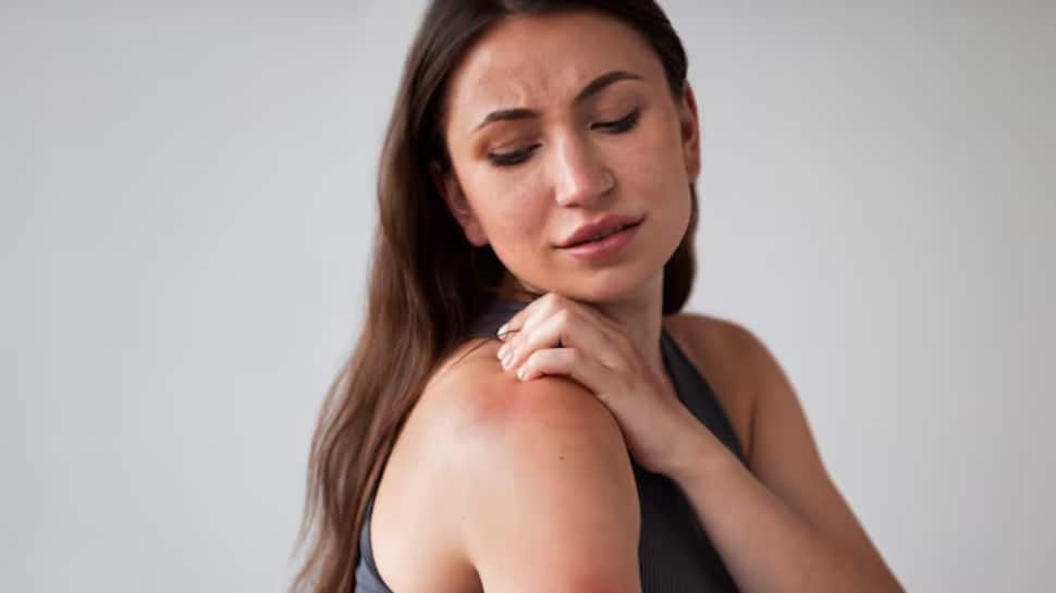 How To Treat Allergies Naturally At Home: 5 Effective Remedies That Really Work