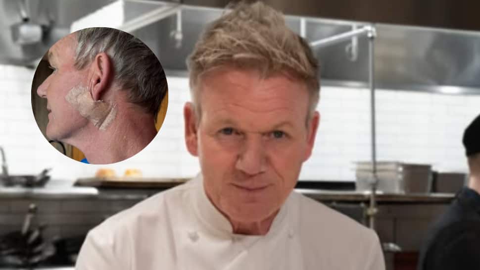 Gordon Ramsay Reveals Skin Cancer Diagnosis, Urges Fans To Use Sunscreen: 'It’s Not A Facelift'