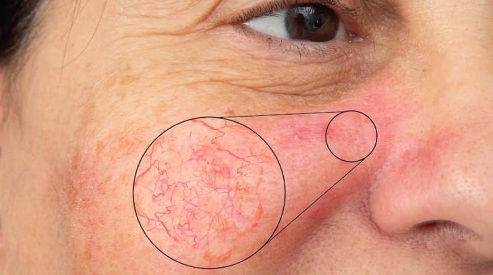 How Climate Change Is Quietly Damaging Your Skin?