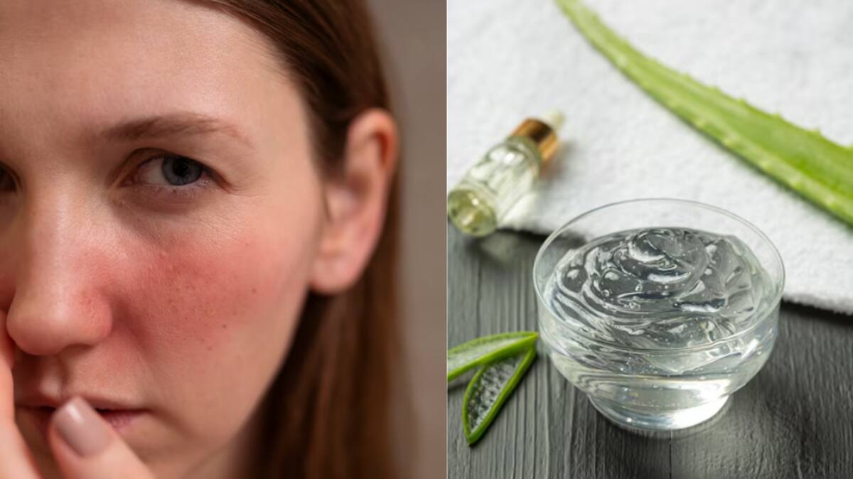 can you use aloe vera as a moisturizer Soothing Aloe Vera Gel