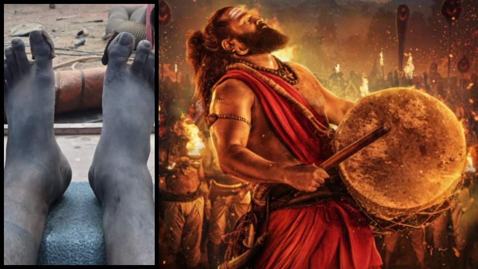 Rishab Shetty Injured During ‘Kantara: Chapter 1’, Reveals Shooting Climax With Swollen Leg