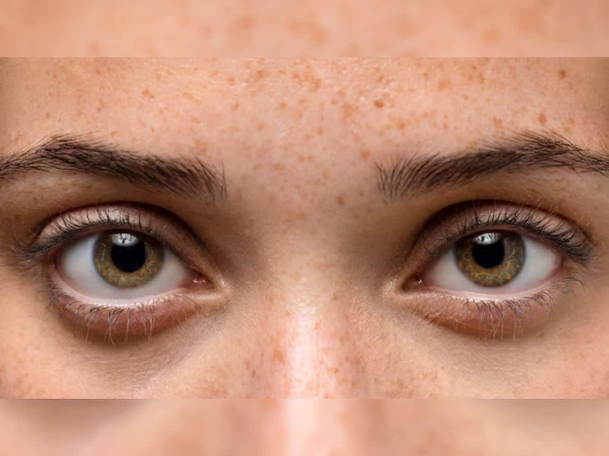 Eye Scans Could Reveal How Fast You’re Ageing And Your Heart Disease Risk, Study Finds