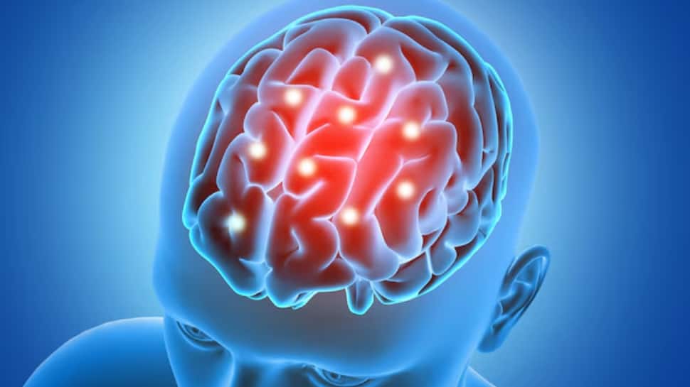 Rising Brain Stroke Cases In India: Experts Reveal How Lack Of Sleep And Stress Are Putting Even Young Adults At Risk Rising Brain Stroke Cases In India: Experts Reveal How Lack Of Sleep And Stress Are Putting Even Young Adults At Risk