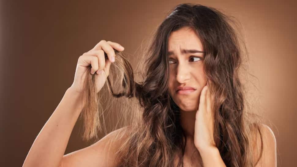 Why Does Your Hair Get Frizzy And Dry In Winters? 6 Effective Natural Remedies And Hair Care Tips For Silky, Nourished Locks