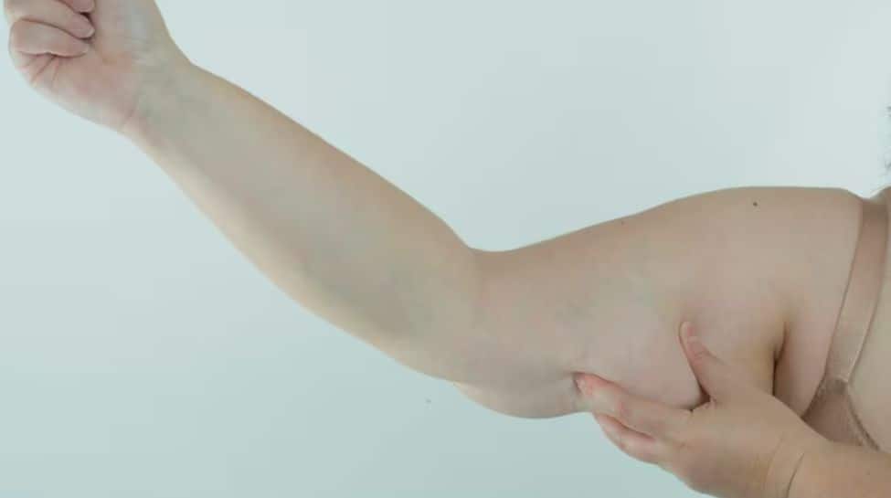 Say Goodbye To Flabby Arms: Try THESE Yoga Poses To Loose Arm Fat