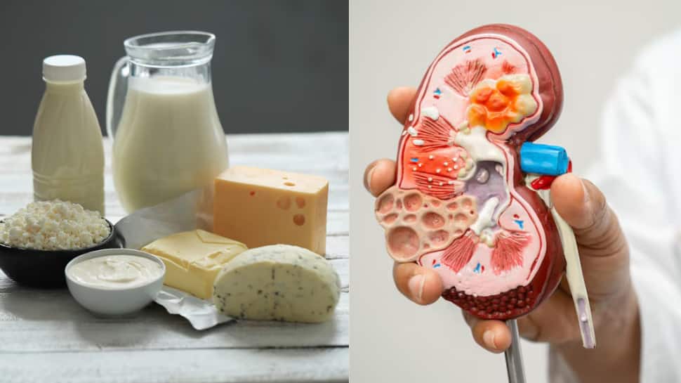 Is Your Daily Diet Secretly Harming Your Kidneys? 5 Foods You Should Stop Eating Now
