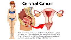 A Preventable Cancer Is Killing A Woman Every Two Minutes - UN Sounds Alarm